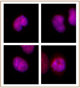 BMI-1 antibody (mAb) tested by Immunofluorescence. Formaldehyde fixed HeLa cells stained with BMI-1 antibody at a 0.5 ug/ml dilution.