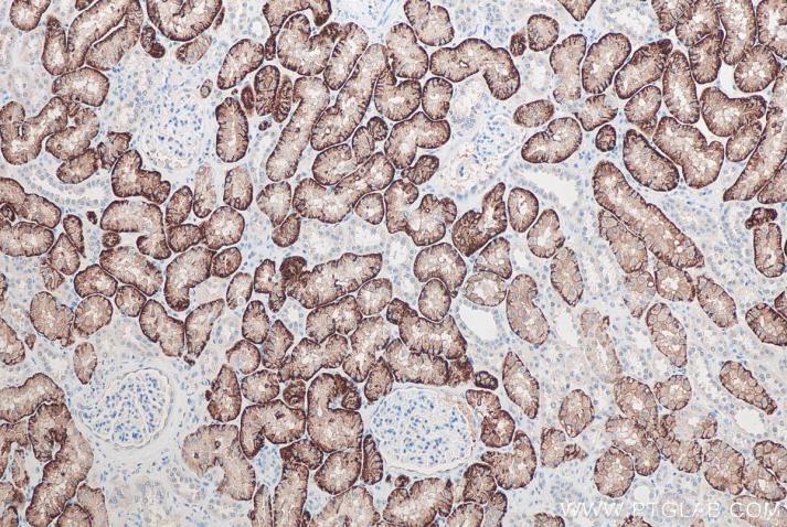 使用 Proteintech 的 SLC13A3 兔多克隆抗体 (26184-1-AP) 和抗小鼠/兔通用型自主全应用免疫组化试剂盒(PK10019) 对人肾脏组织进行免疫组织化学分析。