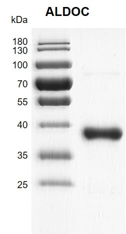 Recombinant ALDOC protein gel 12.5% SDS-PAGE with Coomassie blue staining MW: 40.5 kDa Purity: >92%