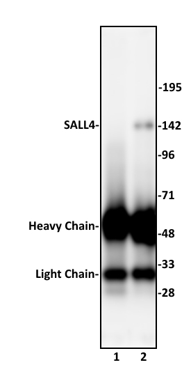 SALL4 antibody (pAb) tested by Immunoprecipitation. 10 ul of SALL4 antibody was used to immunoprecipitate SALL4 from 500 ug of F9 nuclear cell extract (lane 2). 10 ul of rabbit IgG was used as a negative control (lane 1). The immunoprecipitated protein was detected by Western blotting using the SALL4 antibody at a dilution of 1:500.