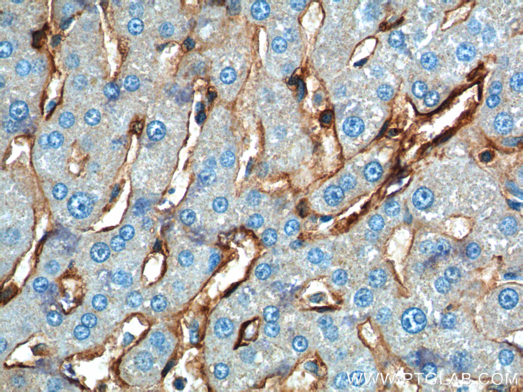IHC of paraffinembedded human liver tissue slide using Annexin A2 antibody (11256-1-AP) at a dilution of 1:200 (40x objective)