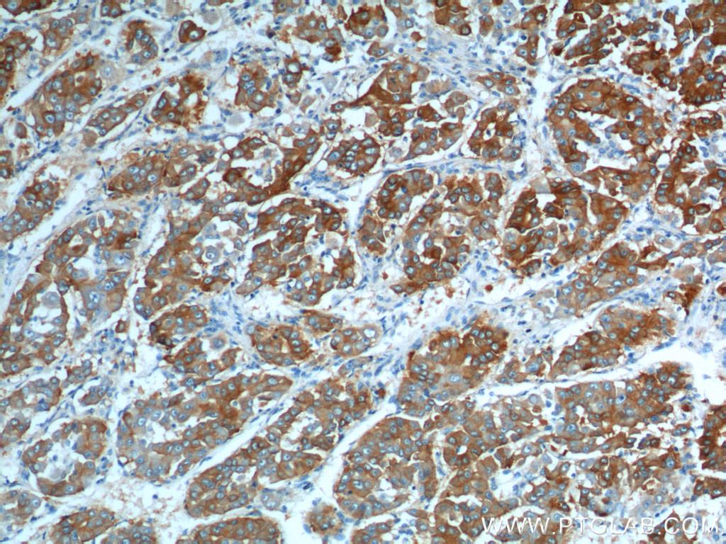 ASGR1 Antibody 11739-1-AP | Proteintech