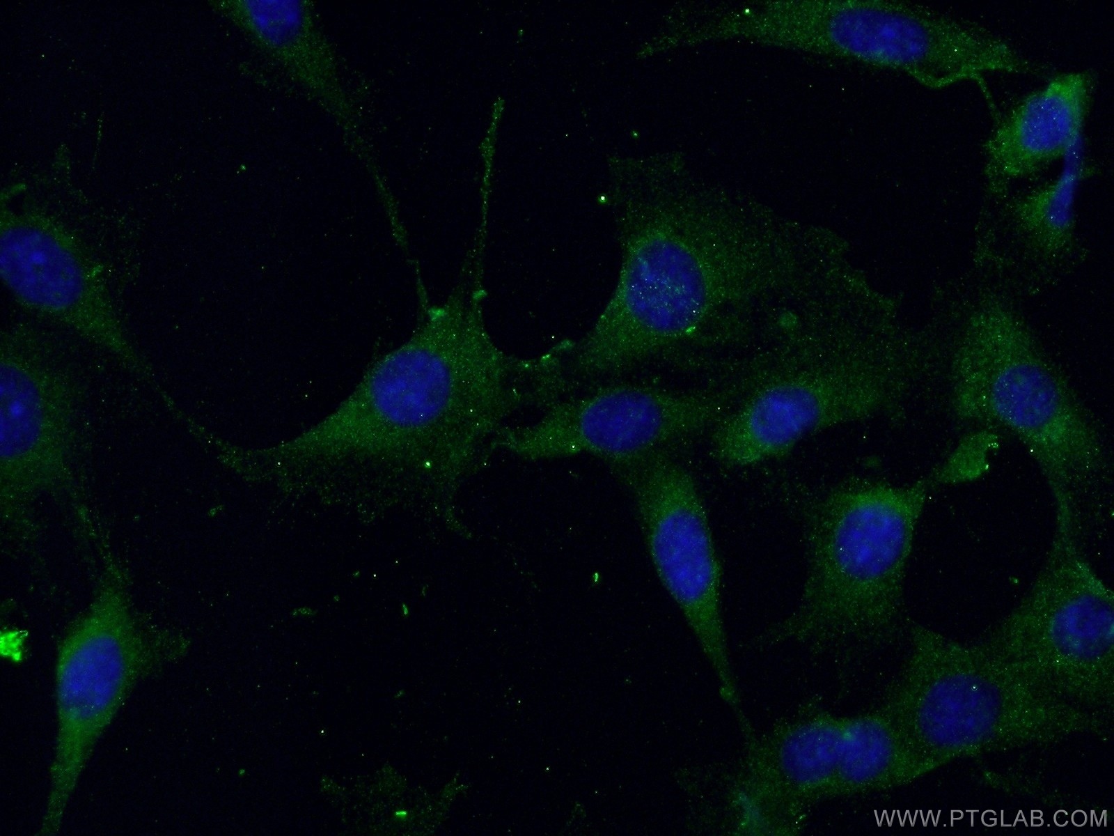 IF analysis of NIH/3T3 cells labeling Beclin 1 antibody (11306-1-AP; 1:50) and Alexa Fluor 488-conjugated AffiniPure Goat Anti-Rabbit IgG(H+L)