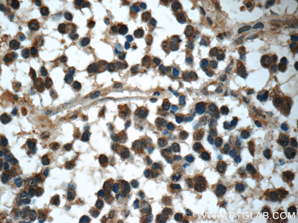 C9orf72 polyclonal antibody validated in IHC