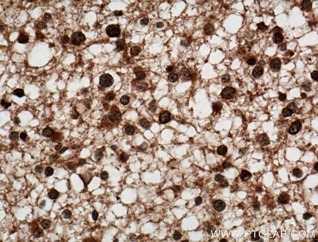 C9orf72 monoclonal antibody validated in IHC