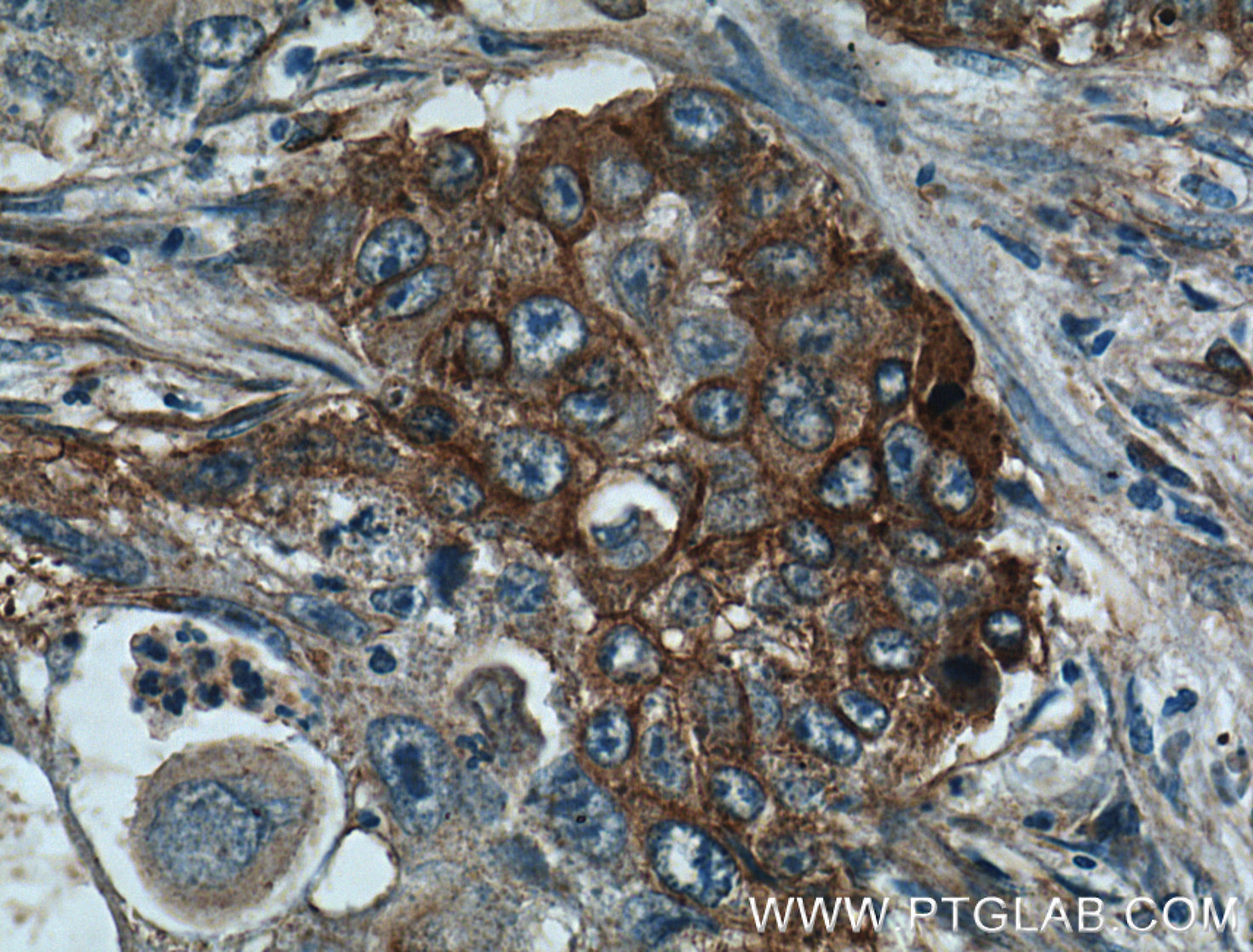 Caveolin 1 antibody 16447 1 ap proteintech