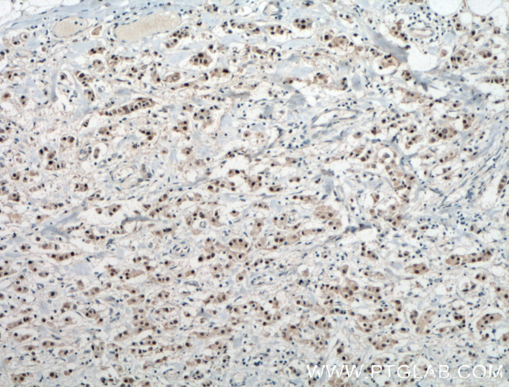 er-antibody-21244-1-ap-proteintech