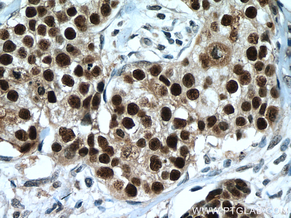 er-antibody-21244-1-ap-proteintech