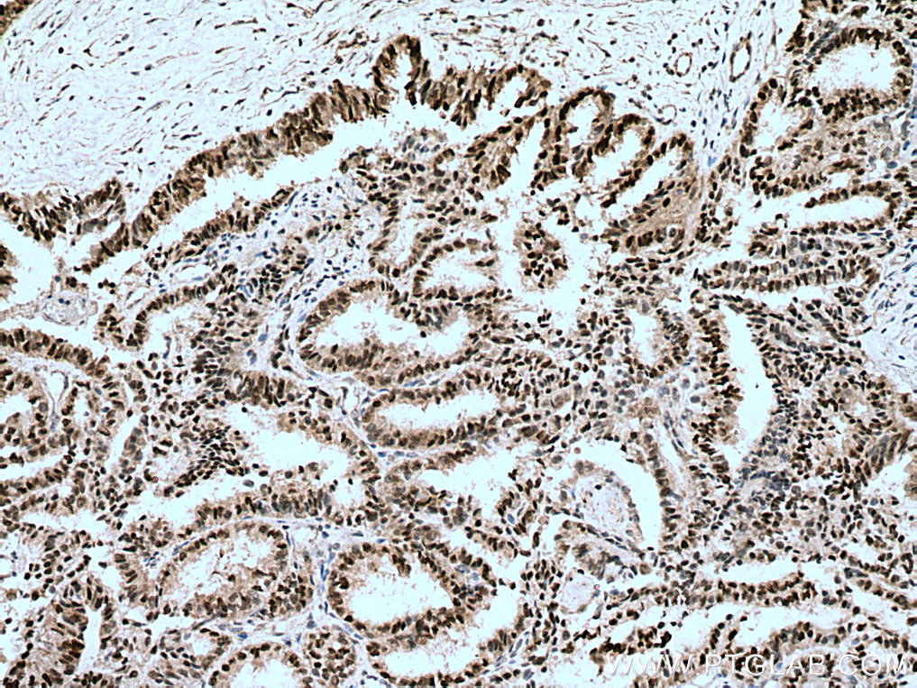 er-antibody-21244-1-ap-proteintech