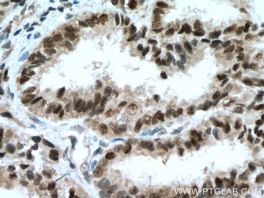 er-antibody-21244-1-ap-proteintech