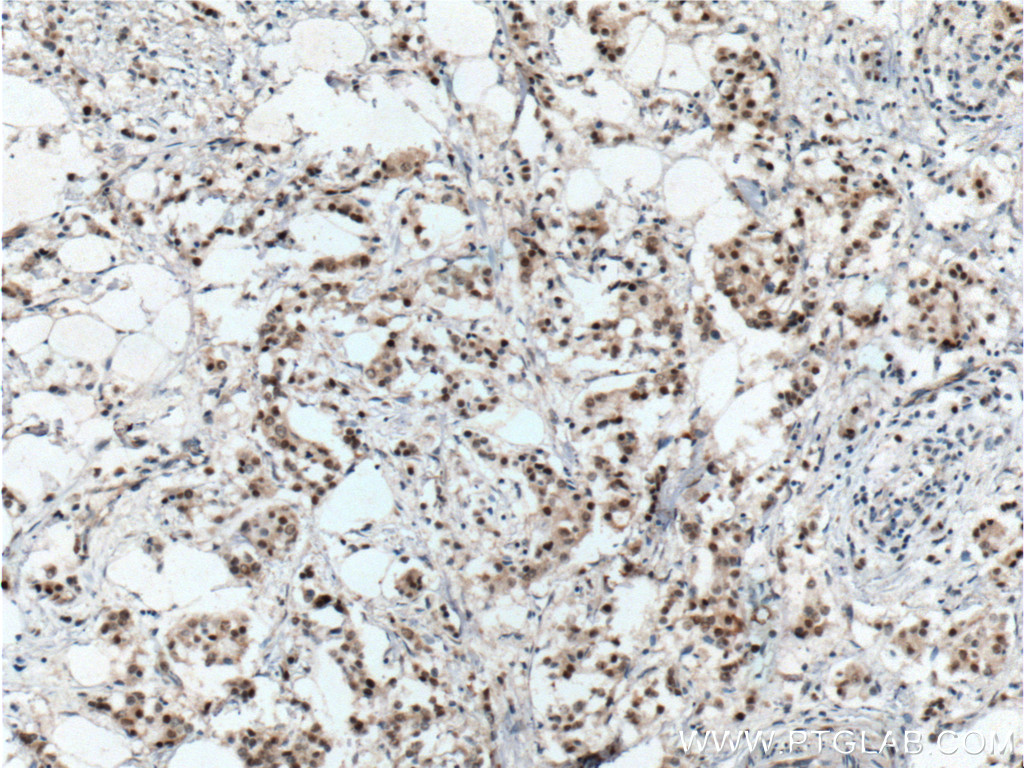 er-antibody-21244-1-ap-proteintech