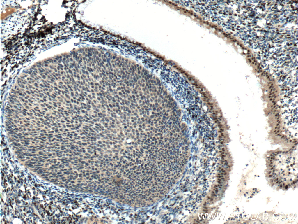 er-antibody-21244-1-ap-proteintech