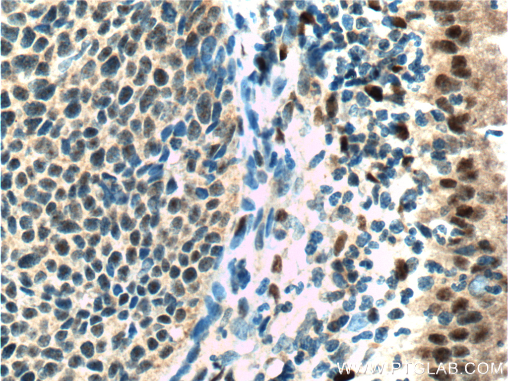 er-antibody-21244-1-ap-proteintech