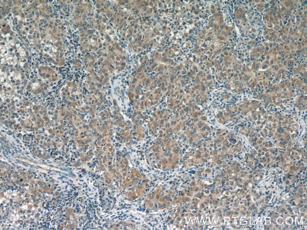 Glutamine Synthetase Antibody 2 Ap Proteintech