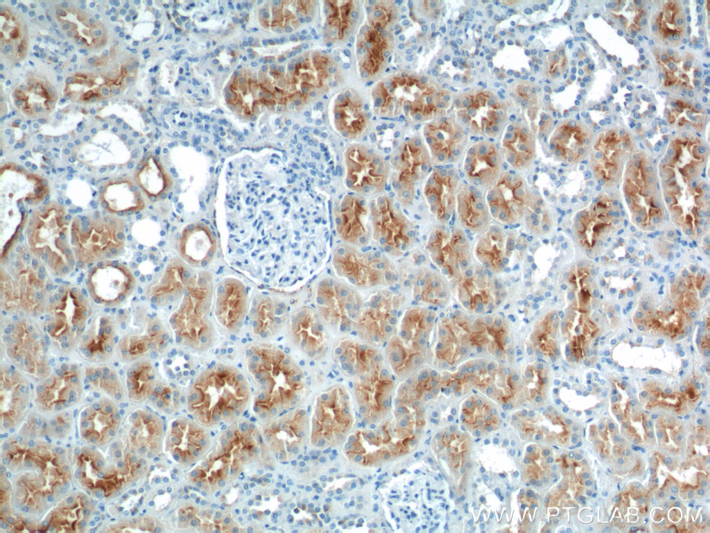 lrp2-specific-antibody-19700-1-ap-proteintech