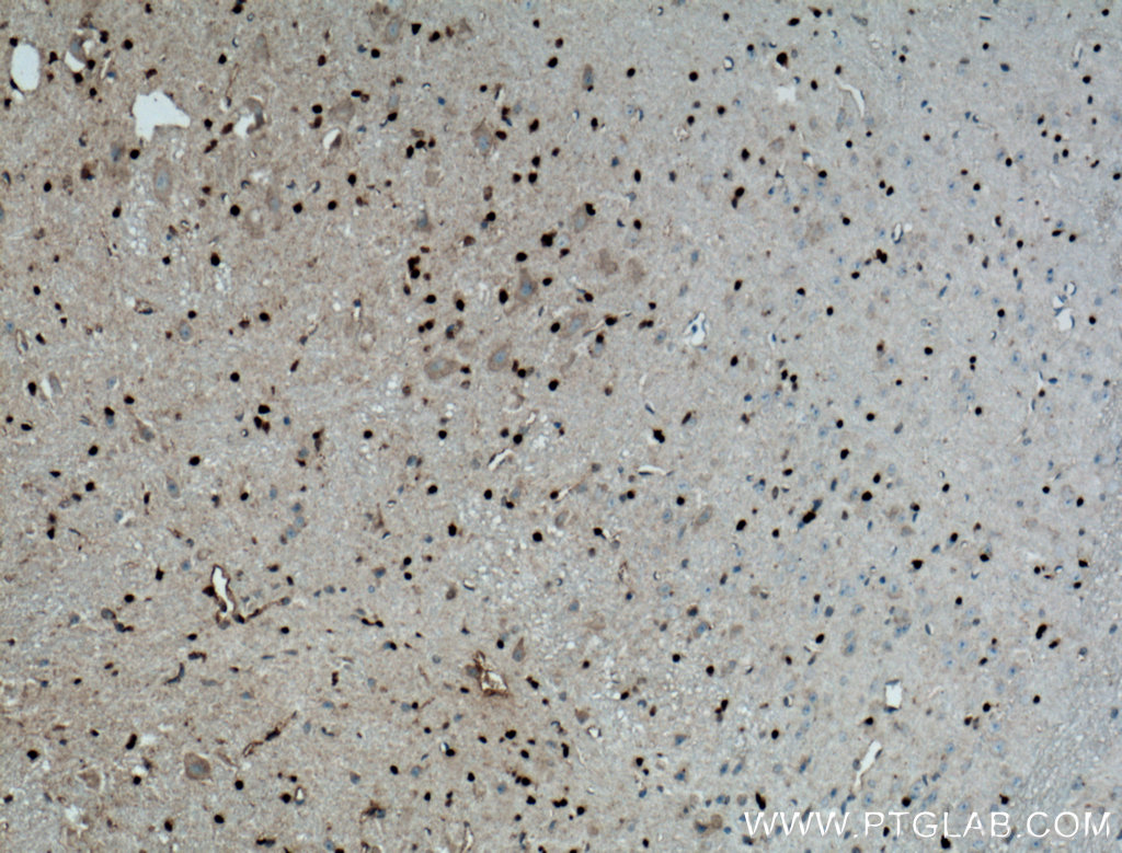 OLIG2 Antibody 13999 1 AP Proteintech olig2-antibody-13999-1-ap-proteintech
