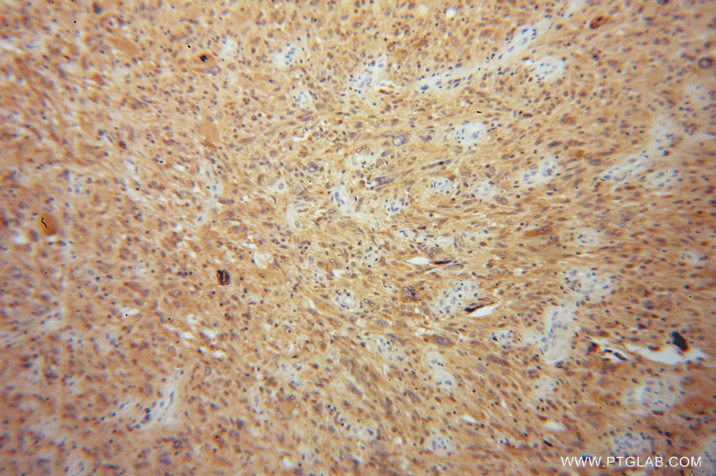 OLIG2 Antibody 13999 1 AP Proteintech olig2-antibody-13999-1-ap-proteintech