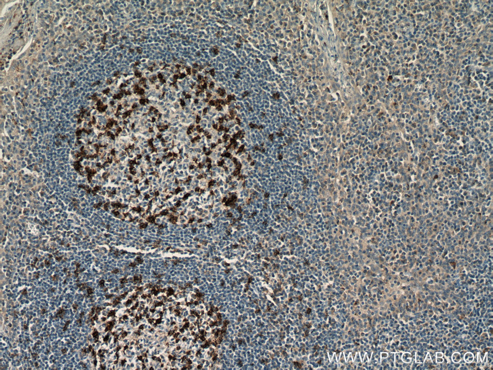 Immunohistochemical analysis of paraffin-embedded human tonsillitis tissue slide using 18106-1-AP (PD-1/CD279 antibody) at dilution of 1:800 (under 10x lens) heat mediated antigen retrieved with Tris-EDTA buffer(pH9