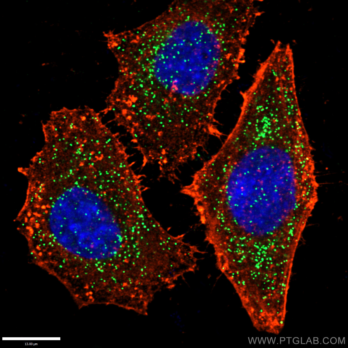 Immunofluorescent image of peroxisomes