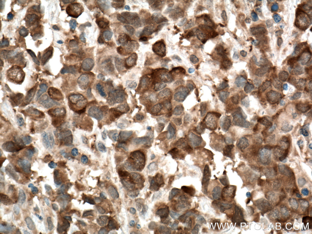 PPAR Gamma Antibody 16643-1-AP | Proteintech