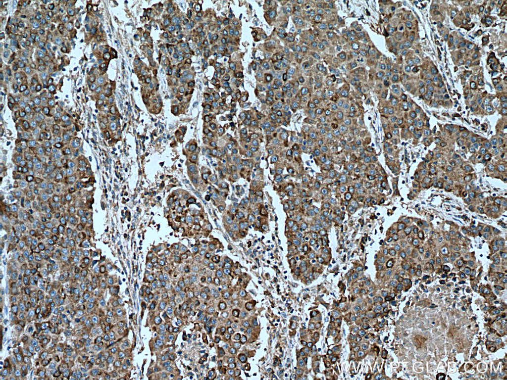 PPAR Gamma Antibody 16643-1-AP | Proteintech