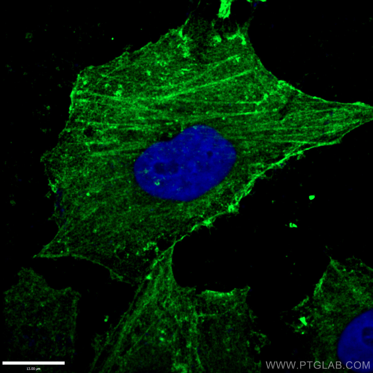 IF analysis of ( -20℃ Ethanol ) fixed HepG2 cells using 66009-1-Ig(beta Actin antibody) at dilution of 1:200 and Alexa Fluor 488-conjugated AffiniPure Goat Anti-Mouse IgG(H+L)