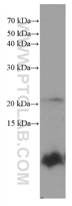 S100 Beta Antibody 1 Ig Proteintech S100 Beta Antibody 1 Ig Proteintech