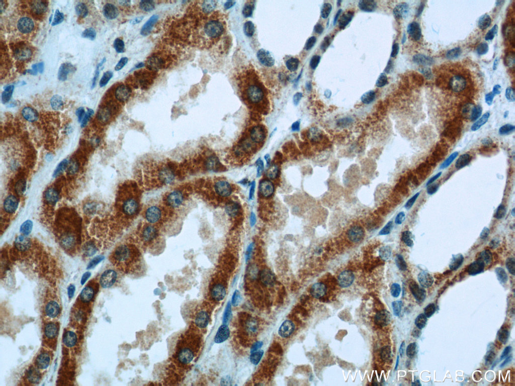 IHC staining of human kidney tissue using 14865-1-AP