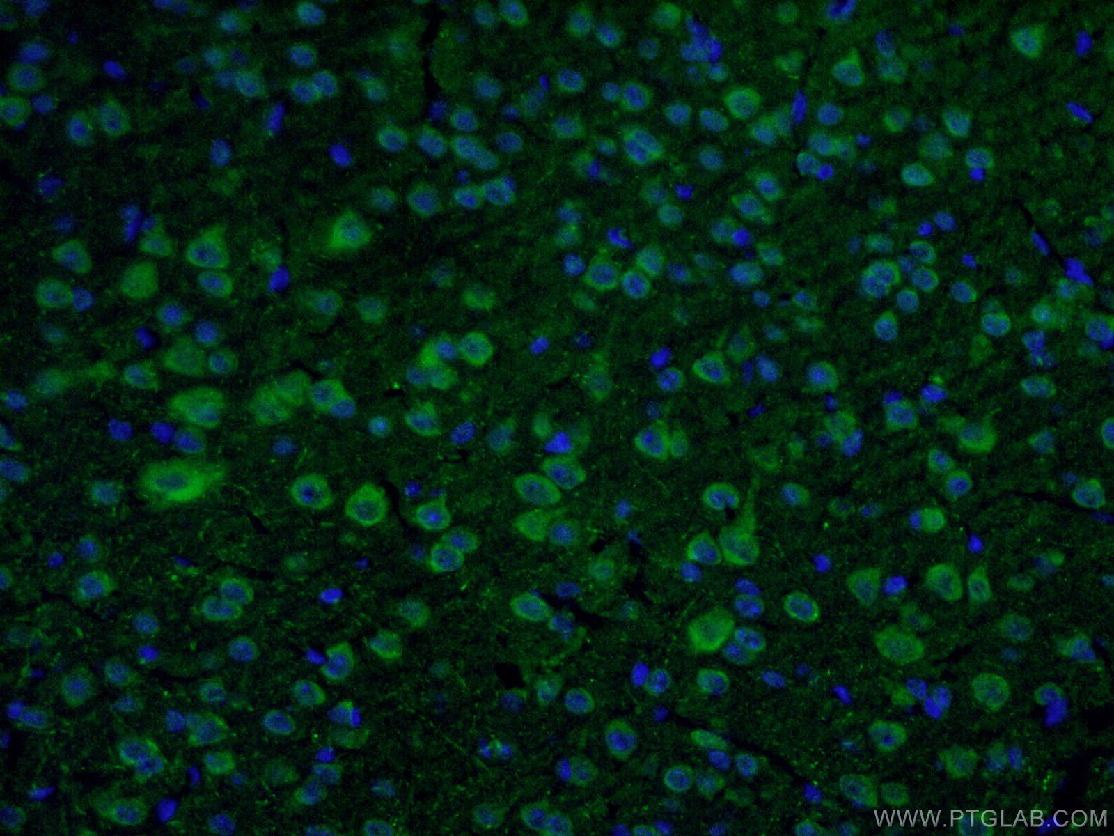 IF staining of mouse brain tissue using 22524-1-AP