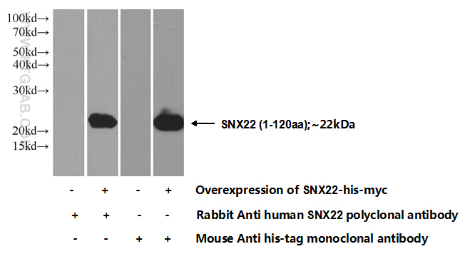 13062-1-ap;transfected hek-293 cells