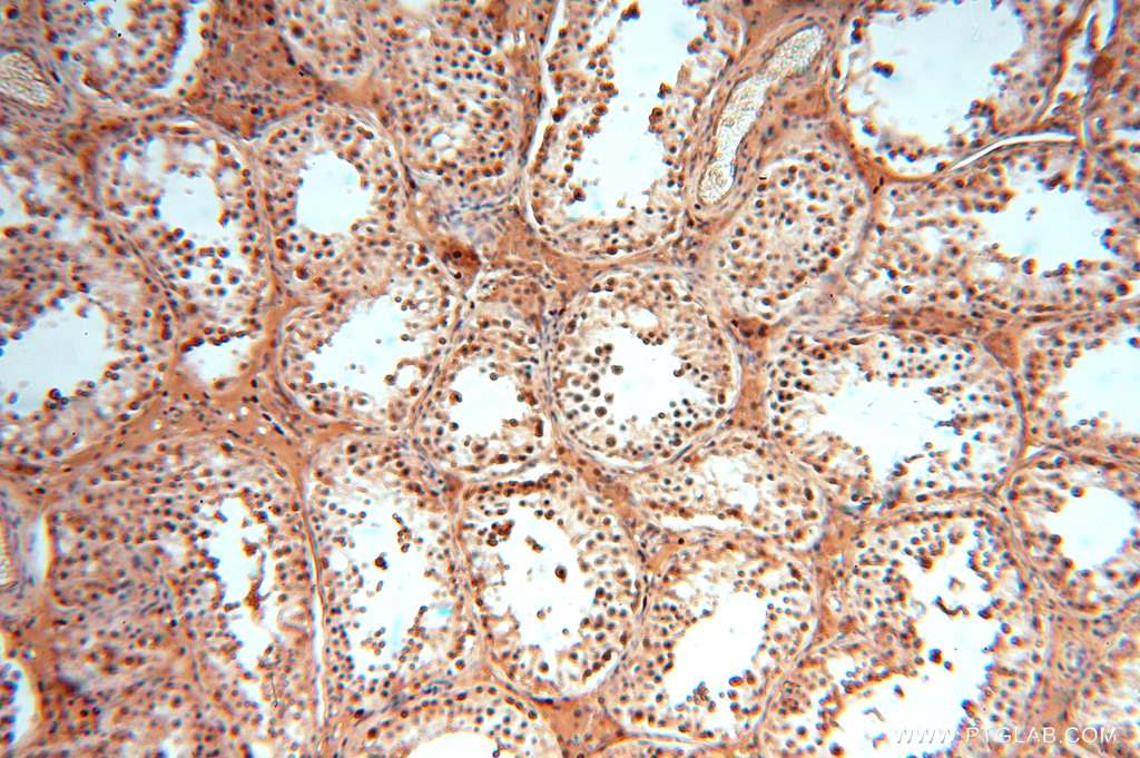 SOD1 antibody validated in IHC