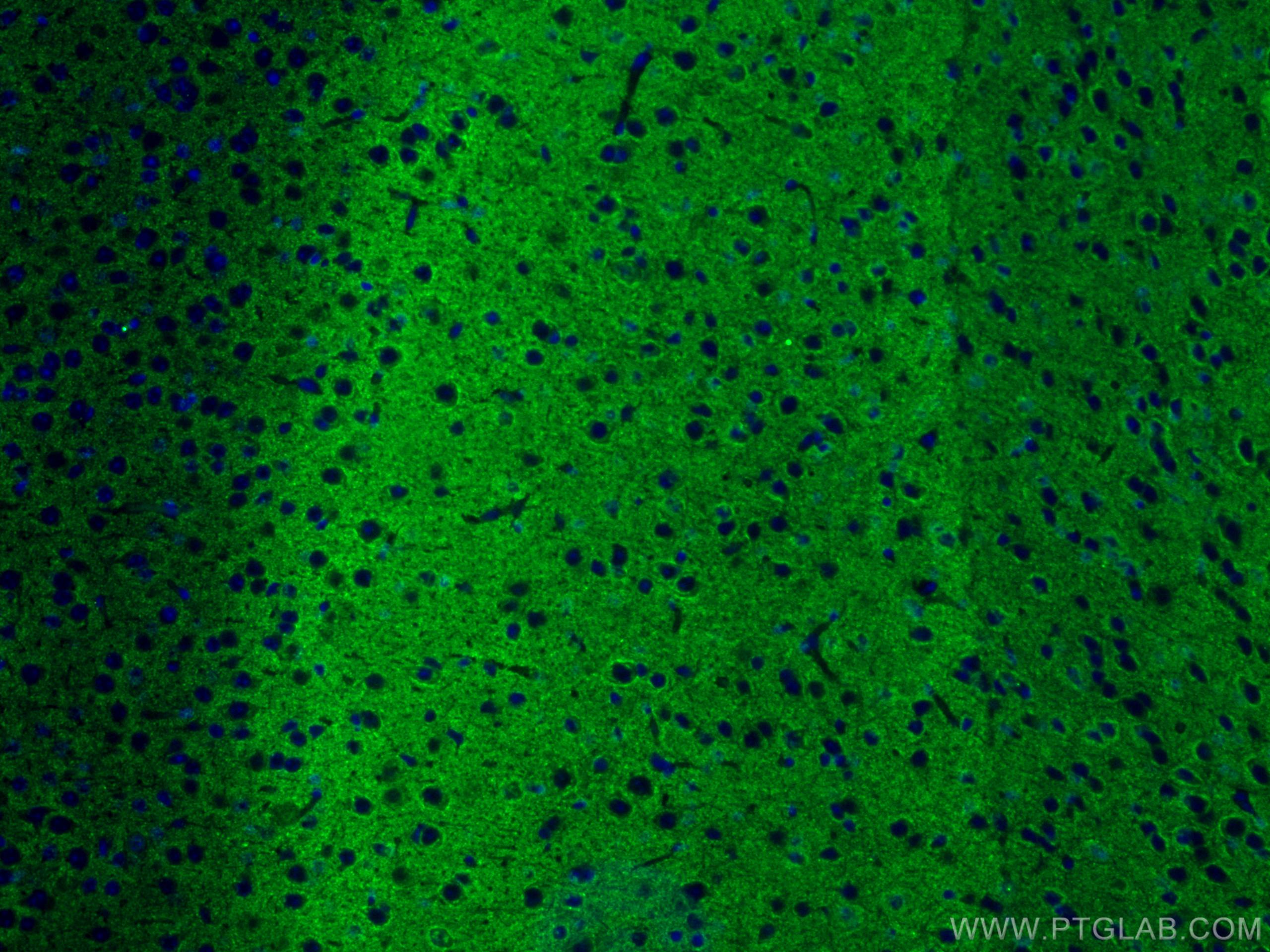 Syp Stained Synaptophysin Antibody 17785-1-AP | Proteintech