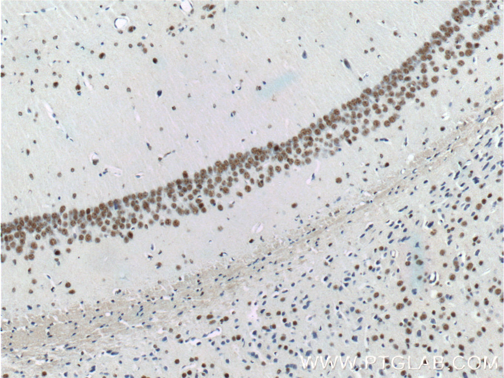 TDP43 antibody validated in IHC