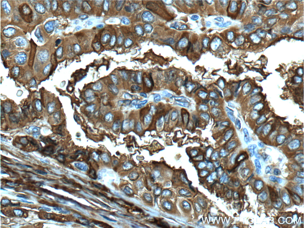 Thyroglobulin antibody 60272 1 ig proteintech
