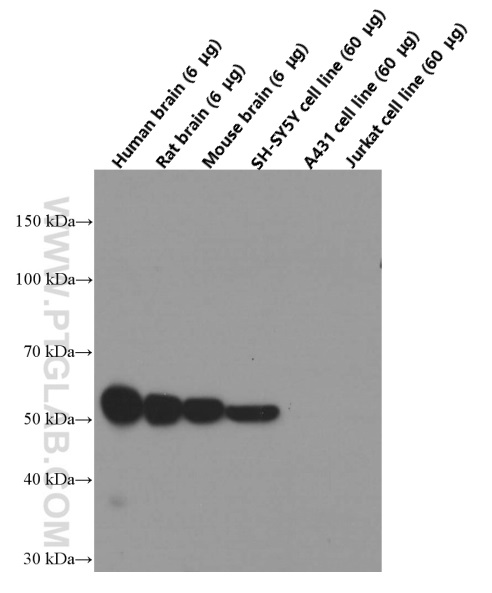 Tubb3 Specific Antibody 1 Ig Proteintech