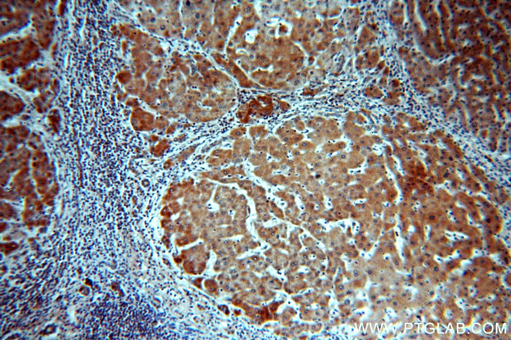 19563-1-ap;human hepatocirrhosis