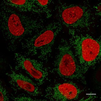 Staining image of HeLa cells transfected with Tom70-eGFP and PCNA-mRFP and stained with GFP-Booster Alexa Fluor 488 (green) and RFP-Booster Alexa Fluor 568 (red) recorded at the Core Facility Bioimaging, LMU Munich