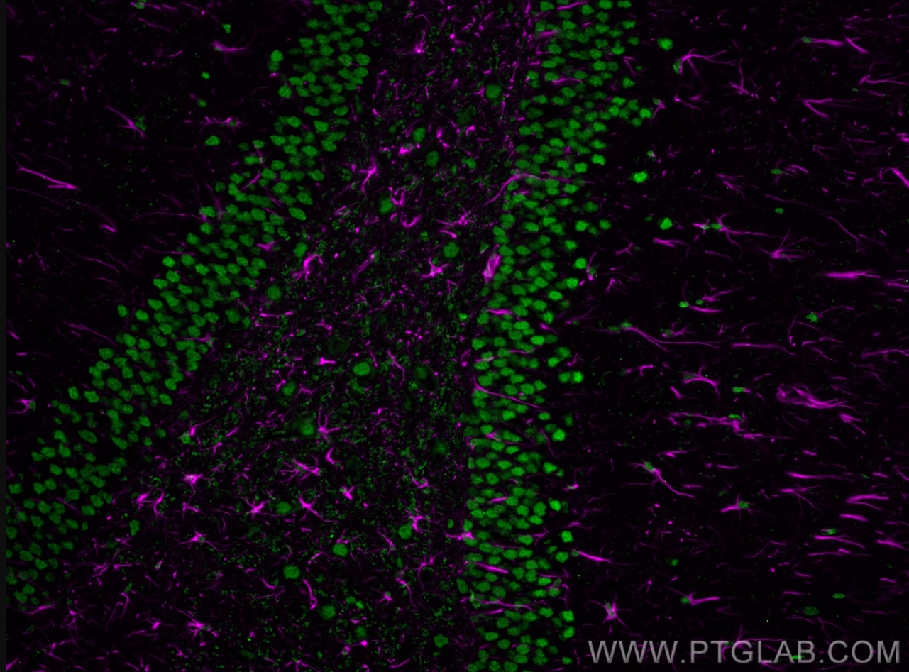 Immunofluorescence (IF) analysis of rat brain FFPE section stained with rabbit anti-GFAP polyclonal antibody (16825-1-AP, magenta) and mouse anti-NeuN monoclonal antibody (66836-1-Ig, green). Multi-rAb CoraLite® Plus 647-Goat Anti-rabbit Secondary Antibody (H+L) (RGAM005, 1:500) and Multi-rAb CoraLite® Plus 488-Goat Anti-Mouse Recombinant Secondary Antibody (H+L) were (RGAM002, 1:500) used for detection.  