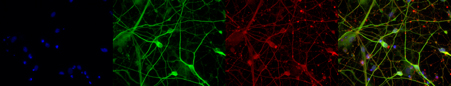 Immunofluorescent staining of MAP2 and TUBB3 antibodies