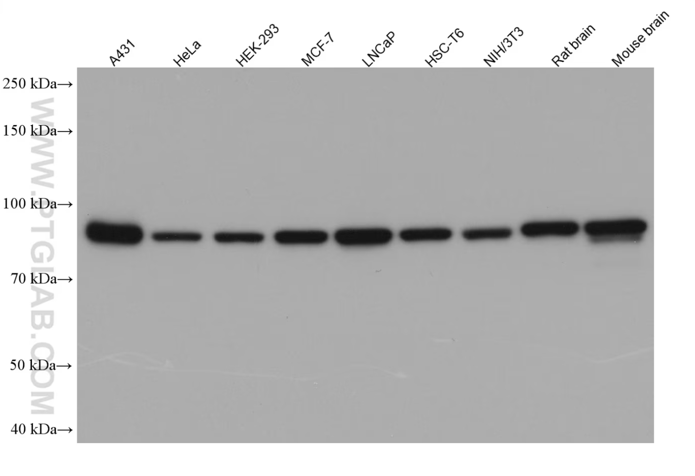 Various lysates were subjected to SDS-PAGE followed by western blot (WB) with anti-beta catenin rabbit polyclonal antibody (51067-2-AP) at a dilution of 1:50000. Multi-rAb HRP-Goat Anti-Rabbit Recombinant Secondary Antibody (H+L) (RGAR001) was used at a dilution of 1:20000 for detection.