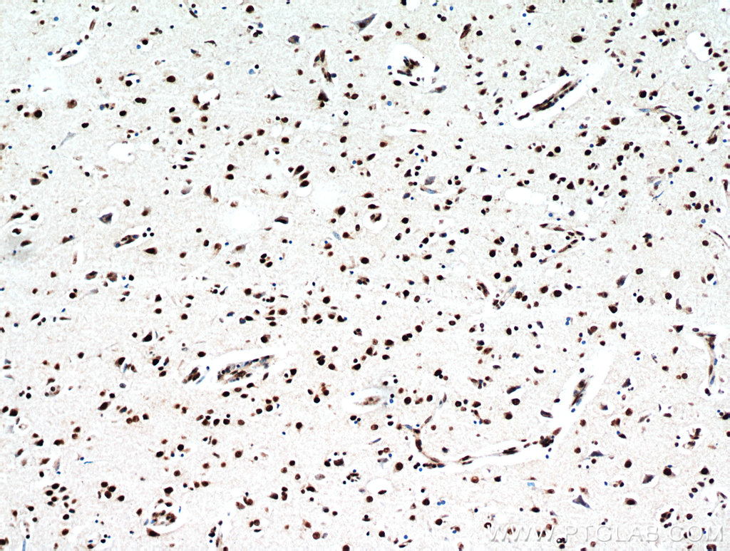 Immunohistochemical of paraffin-embedded human brain using TDP43/TARDBP antibody