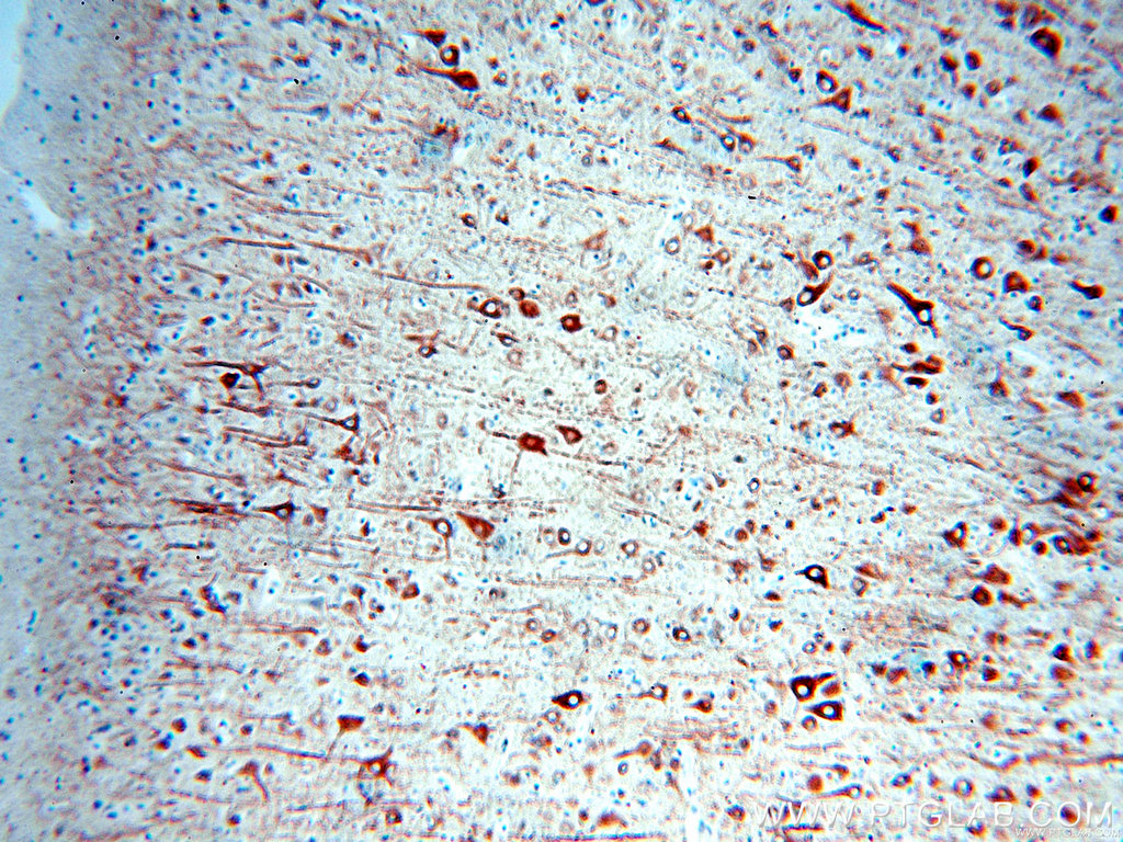 Immunohistochemical of paraffin-embedded human brain using MAP2 antibody