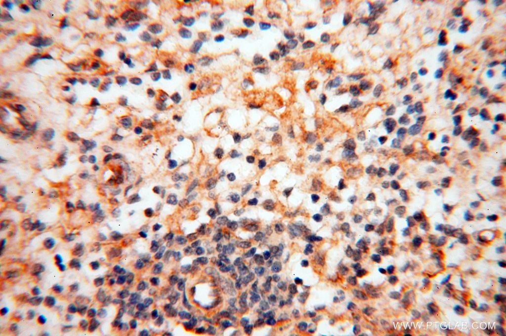 Immunohistochemistry of paraffin-embedded human spleen using CD33 antibody