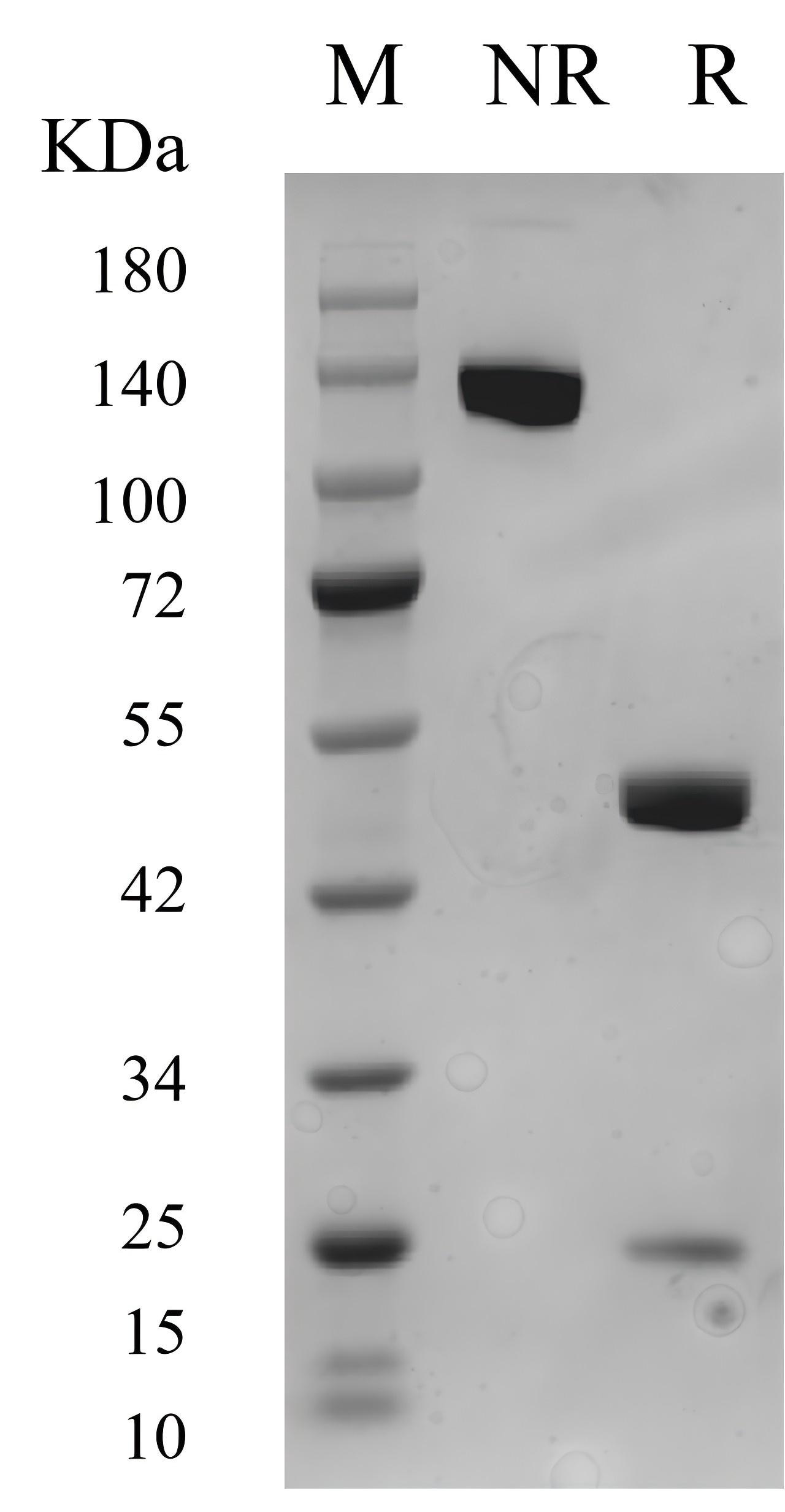 Purity of LE/AF Purified Rabbit Anti-Human CD28 Antibody (Cat. No. BK00001, Clone: 240354D2) was determined by SDS-PAGE. The antibody was resolved in an SDS-PAGE in reducing (R) and non-reducing (NR) conditions and stained using Coomassie blue.