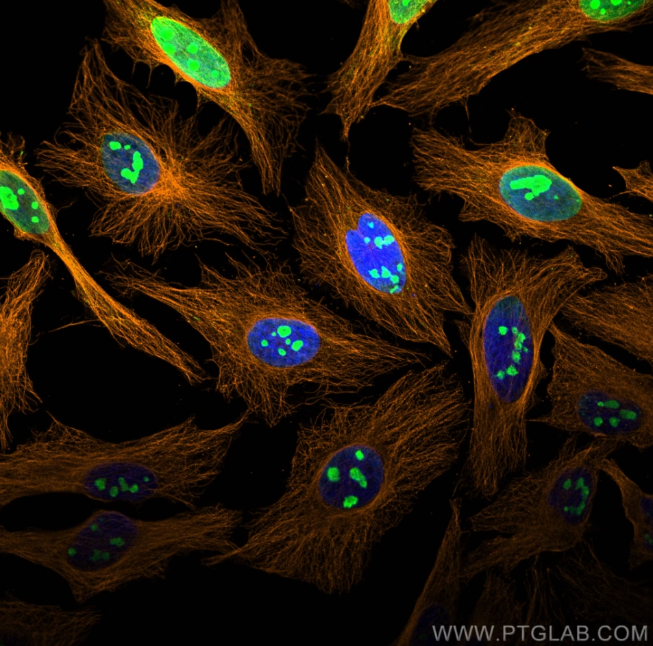 Immunofluorescence (IF) analysis of Hela cells stained with rabbit anti-Alpha Tubulin polyclonal antibody (11224-1-AP, orange) and mouse anti-NPM1 monoclonal antibody (60096-1-Ig, green). Multi-rAb CoraLite® Plus 555-Goat Anti-Rabbit Recombinant Secondary Antibody (H+L) (RGAR003, 1:500) and Multi-rAb CoraLite® Plus 488-Goat Anti-Mouse Recombinant Secondary Antibody (H+L) (RGAM002, 1:500) were used for detection.