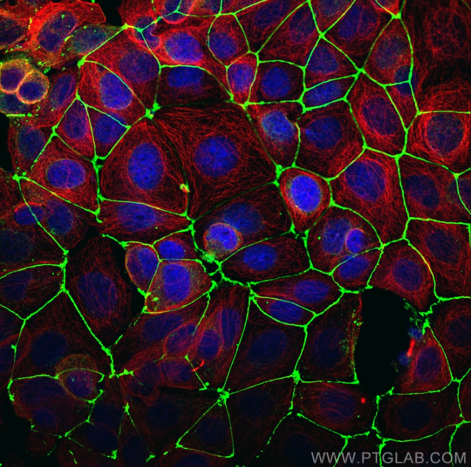 Immunofluorescence (IF) analysis of MCF-7 cells stained with rabbit anti-ZO1 polyclonal antibody (21773-1-AP, green) and mouse anti-Alpha Tubulin monoclonal antibody (66031-1-Ig, red). Multi-rAb CoraLite® Plus 488-Goat Anti-Rabbit Recombinant Secondary Antibody (H+L) (RGAR002, 1:500) and Multi-rAb CoraLite® Plus 594-Goat Anti-Mouse Recombinant Secondary Antibody (H+L) (RGAM004, 1:500) were used for detection.