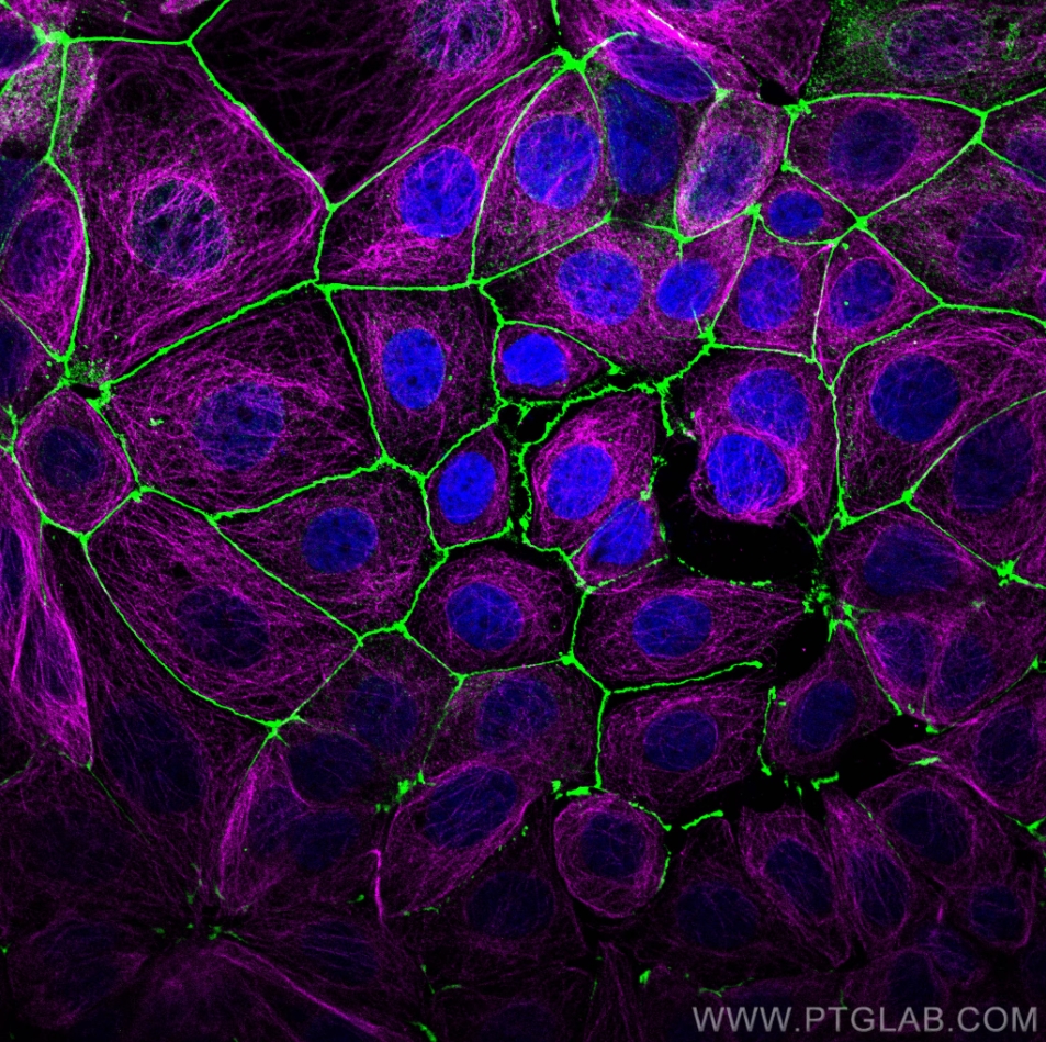 Immunofluorescence (IF) analysis of MCF-7 cells stained with rabbit anti-ZO1 polyclonal antibody (21773-1-AP, green) and mouse anti-Alpha Tubulin monoclonal antibody (66031-1-Ig, magenta). Multi-rAb CoraLite® Plus 488-Goat Anti-Rabbit Recombinant Secondary Antibody (H+L) (RGAR002, 1:500) and Multi-rAb CoraLite® Plus 647-Goat Anti-Mouse Recombinant Secondary Antibody (H+L)</a> (RGAM005, 1:500) were used for detection.  