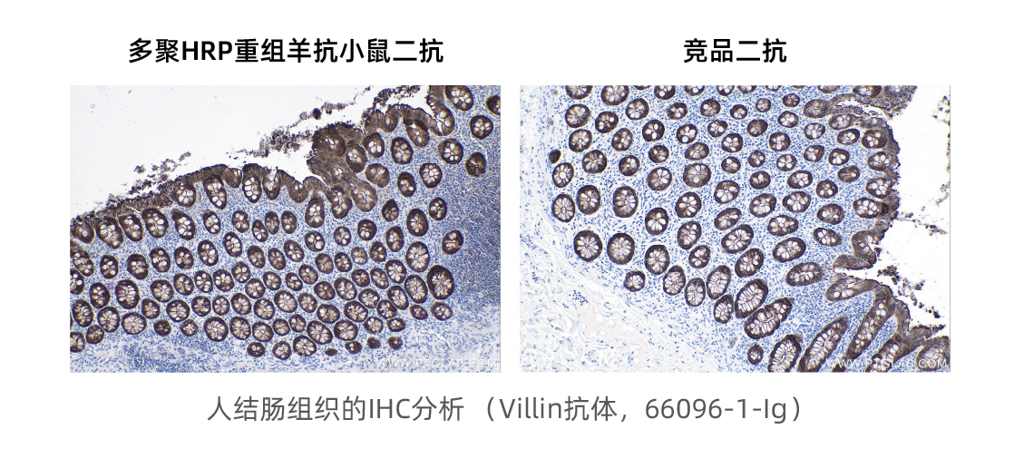 超强信号 1