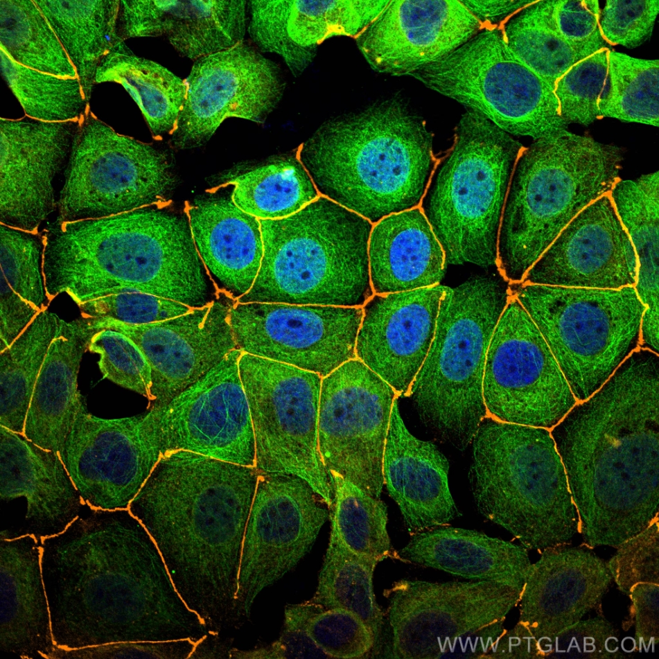 Immunofluorescence (IF) analysis of MCF-7 cells stained with rabbit anti-ZO1 polyclonal antibody (21773-1-AP, orange) and mouse anti-Alpha Tubulin monoclonal antibody (66031-1-Ig, green). Multi-rAb CoraLite® Plus 555-Goat Anti-Rabbit Recombinant Secondary Antibody (H+L) (RGAR003, 1:500) and Multi-rAb CoraLite® Plus 488-Goat Anti-Mouse Recombinant Secondary Antibody (H+L) (RGAM002, 1:500) were used for detection.