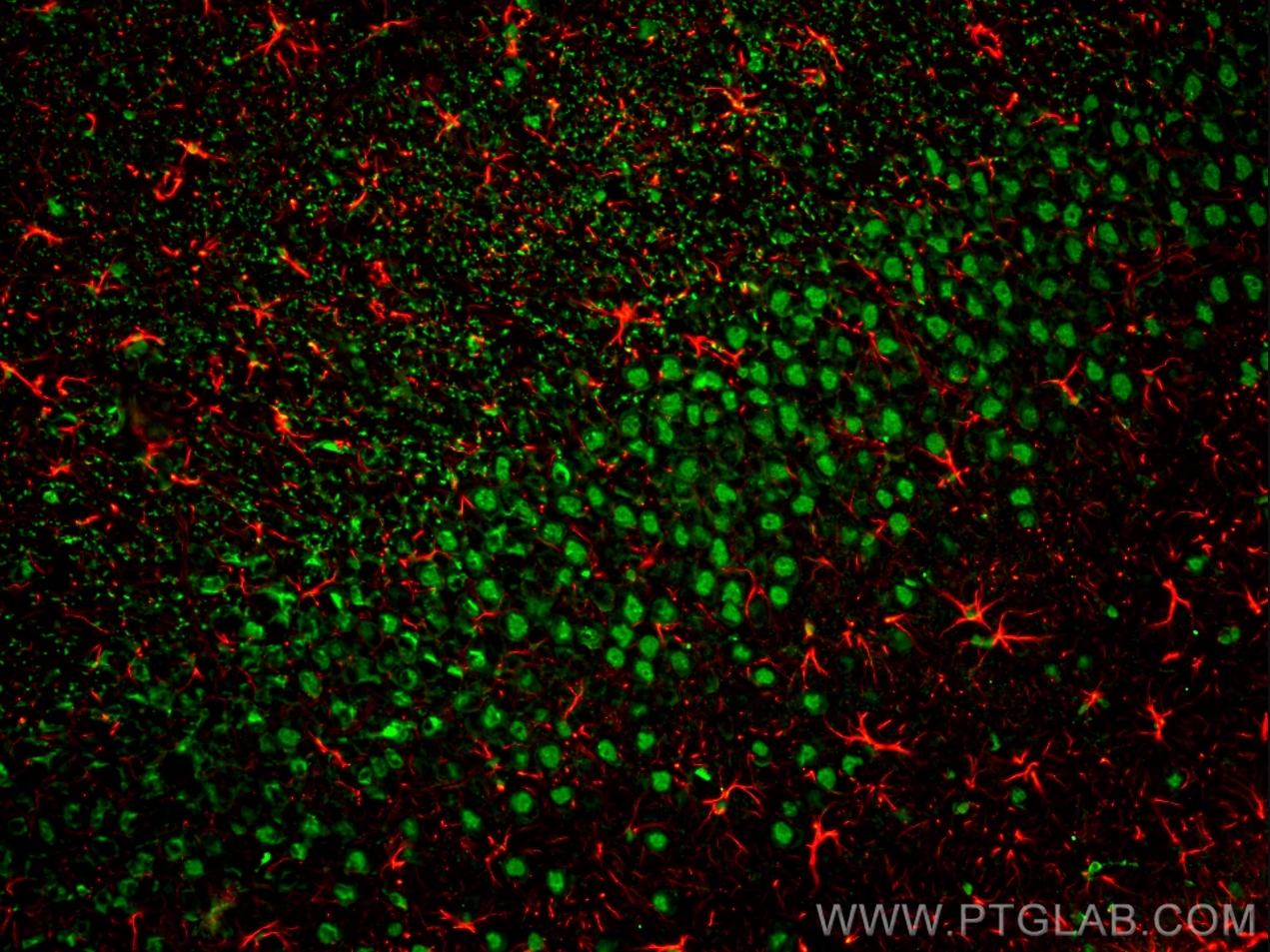 Immunofluorescence (IF) analysis of rat brain FFPE section stained with rabbit anti-GFAP polyclonal antibody (16825-1-AP, red) and mouse anti-NeuN monoclonal antibody (66836-1-Ig, green). Multi-rAb CoraLite® Plus 594 Goat Anti-Rabbit Recombinant Secondary Antibody (H+L) (RGAM004, 1:500) and Multi-rAb CoraLite® Plus 488-Goat Anti-Mouse Recombinant Secondary Antibody (H+L) (RGAM002, 1:500) were used for detection.  